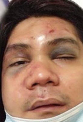 Nagsumbong kay Abunda: Vhong Navarro