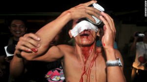 120101102026-philippines-manila-new-year-firecracker-injuries-story-top