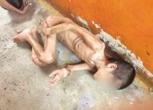 Skin-and-bones: Manila street child 'Federico' reportedly abused in Manila's Reception and Action Center(Photo courtesy Inquirer)